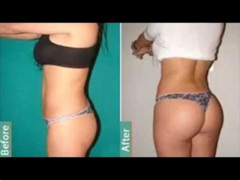 How to heal pulled muscle in buttocks