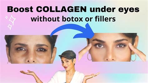 How to increase collagen in eyes