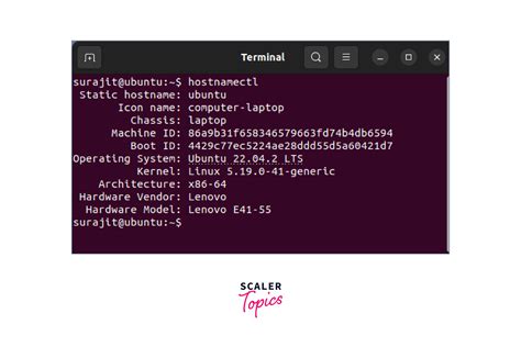 How to install dns server in linux