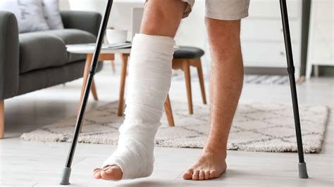 How to know your foot is broken