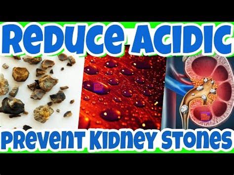 How to lower acidity in urine