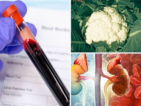 How to lower ammonia in body