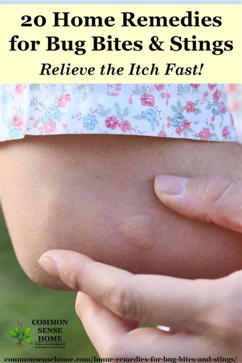 How to make fly bites stop itching