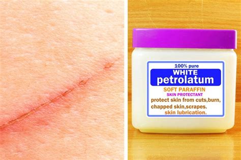 How to prevent a scar