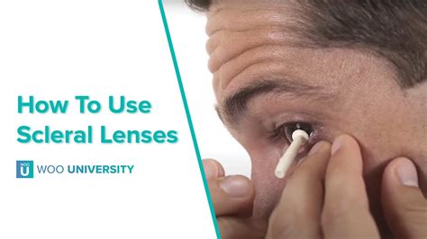 How to put in sclera lenses