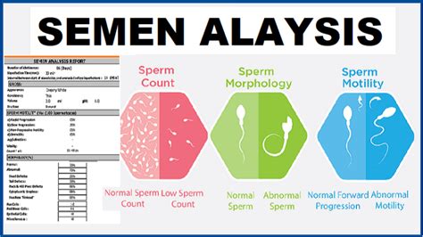 How to read a sperm analysis report.  Understand sperm count, motility, morphology,...