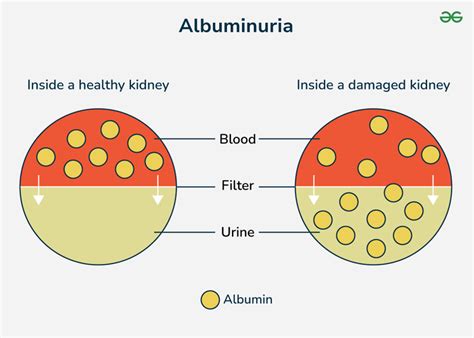 How to reduce albumin in urine