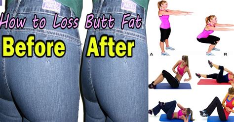 How to reduce buttocks in a week