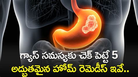 How to reduce gastric problem in telugu