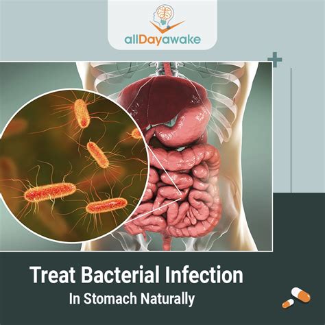 How to reduce infection in stomach