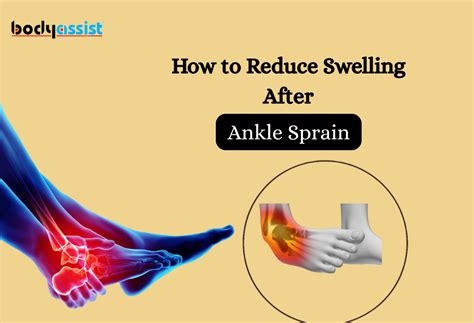 How to reduce swelling in ankle joint