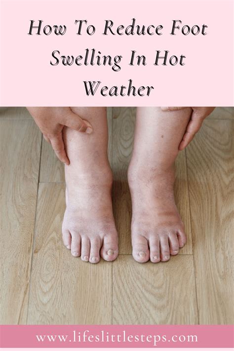 How to reduce swelling in my feet