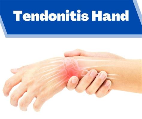 How to relieve tendonitis in hand