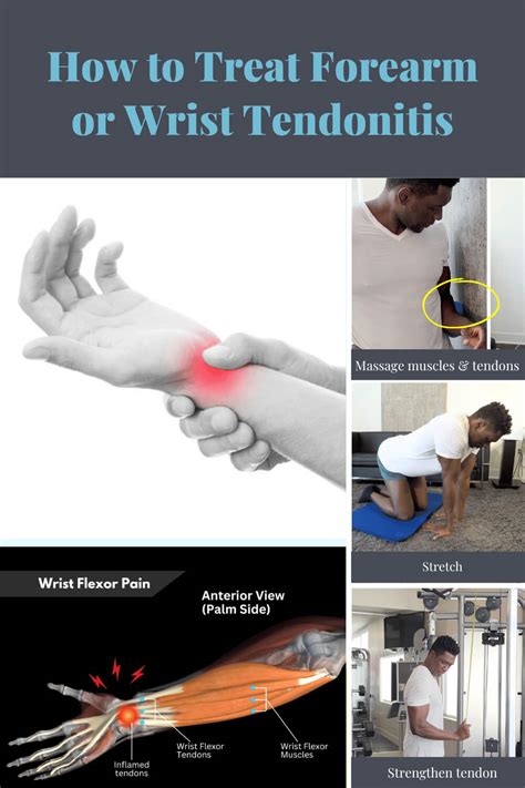 How to relieve tendonitis in wrist
