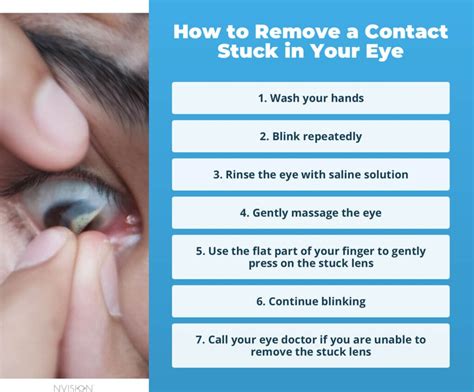 How to remove contact stuck in eye