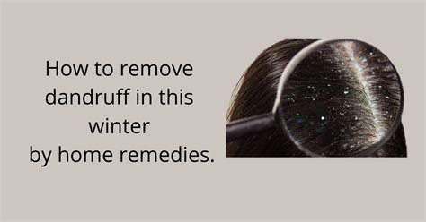 How to remove dandruff in winters