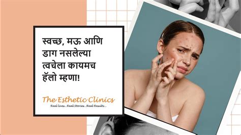 How to remove pimples in marathi