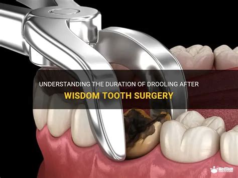 How to stop drooling after tooth extraction