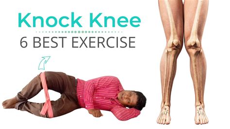 How to stop locking knees