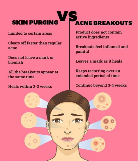 How to stop skin purging immediately. .  ...