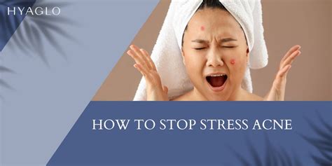 How to stop stress pimples