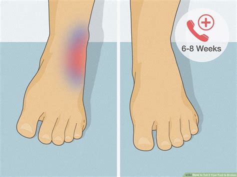 How to tell your foot is broken