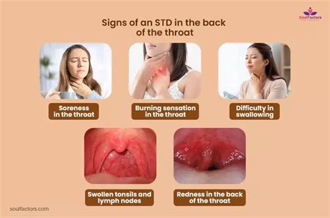 How to test for std in throat
