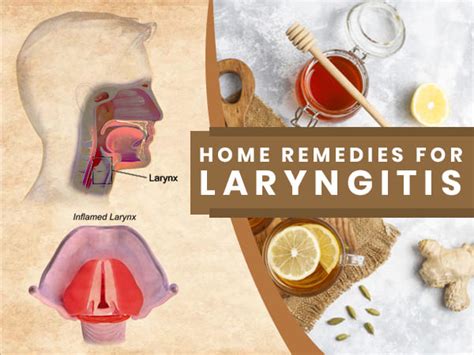 How to treat laryngitis naturally at home – 6 fast tips