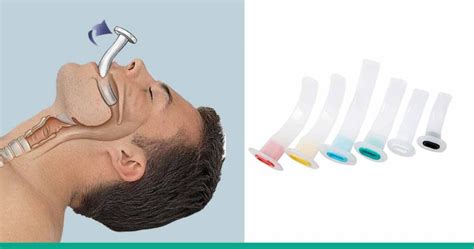 How to use an Oropharyngeal (OP) Airway - First …