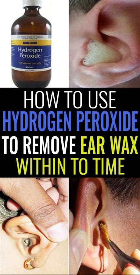 How to use hydrogen peroxide in ear
