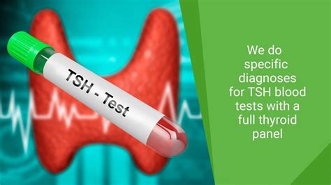 How tsh test is done