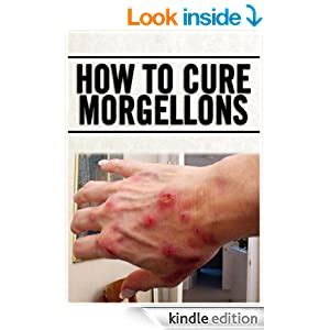 Read Online How To Cure Morgellons By Michael Chapala