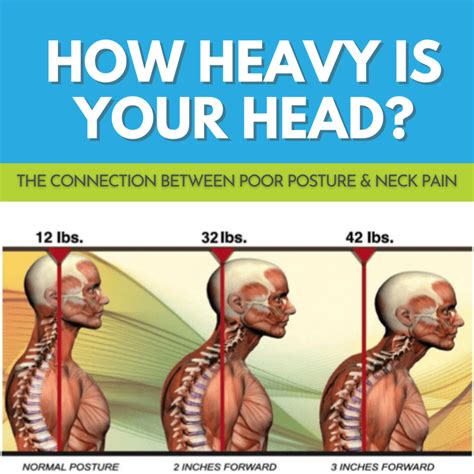 HowPoorPostureAffectsNeckMuscles