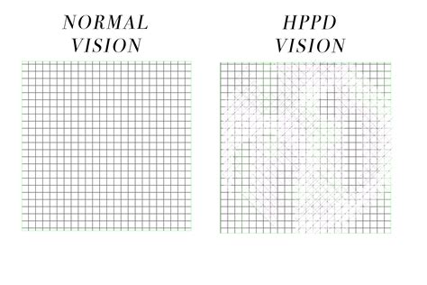 Hppd for dummies.  HPPD consists of lasting feelings of intoxication, visuals,...