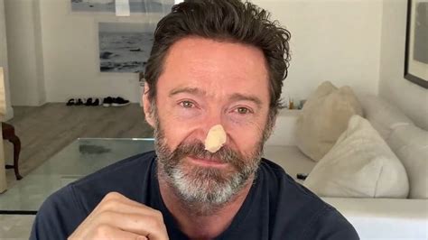Hugh Jackman undergoes skin cancer tests and encourages sun safety