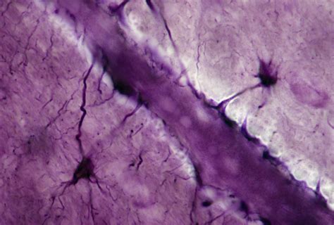 Human BloodBrain Barrier Lab Models Have a Problem