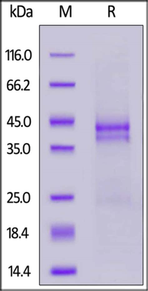 Human CTGF / CCN2 Protein, His Tag