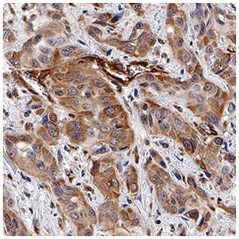 Human Phospho-MLKL (T357) Antibody