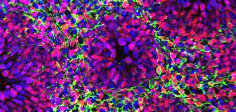 Human brain organoid research sheds light on neurological development ...