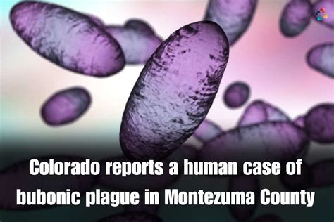 Human case of plague found in Montezuma County