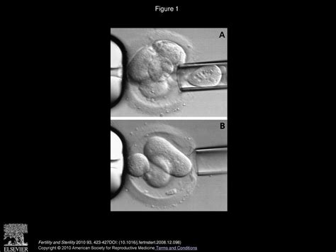 Human embryo twinning with applications in reproductive medicine