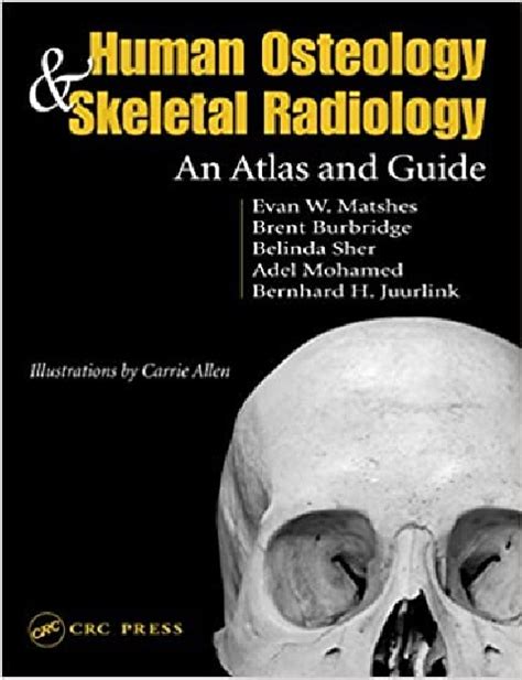 Human osteology skeletal radiology an atlas and guide. - The narrow road a brief guide to the getting of.