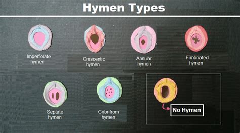 Hymen Onlyfans Leak