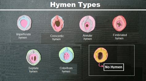 Hymen close up
