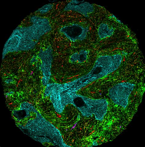 Hyperion - Image mass cytometry Flow Cytometry Core Facility