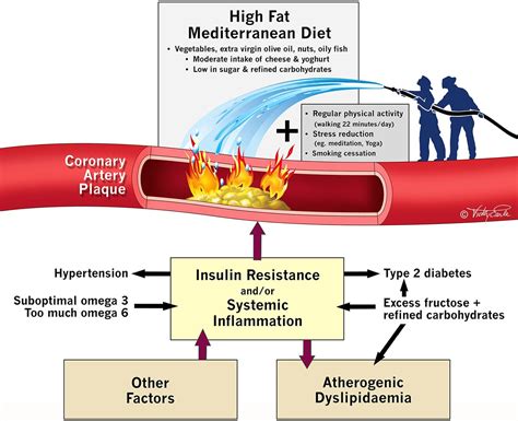 Hyperlipidemia and cardiovascular disease: inflammation, …