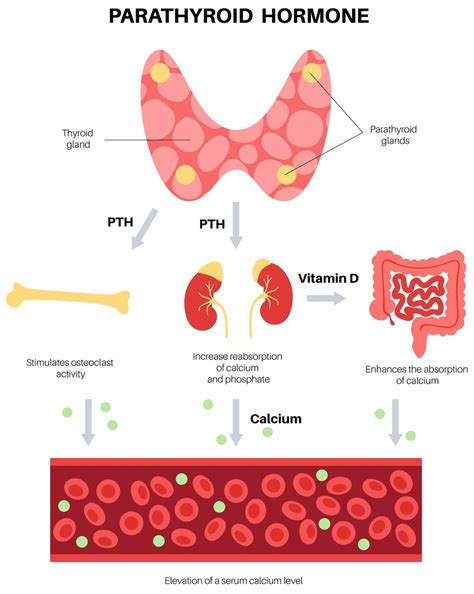 Hyperparathyroidism and Bone Health SpringerLink