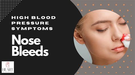 Hypertension Nose Bleeds - ﻿Jayline