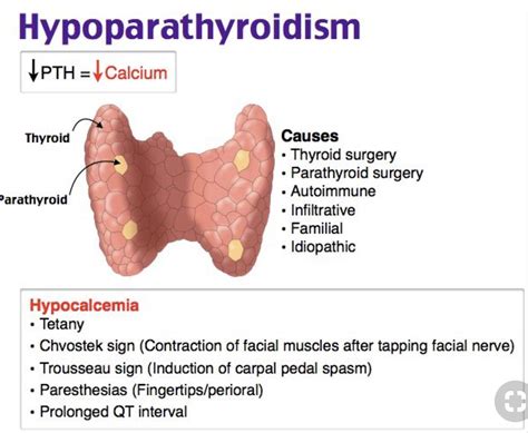 Hypoparathyroidism in Emergency Medicine - Medscape