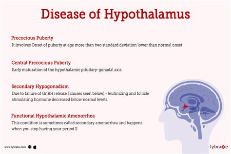 Hypothalamic syndrome - PubMed